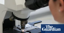 New AI test can predict which men will benefit from prostate cancer drug