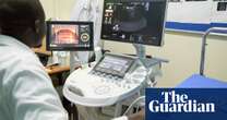 ‘I am happy to see how my baby is bouncing’: the AI transforming pregnancy scans in Africa