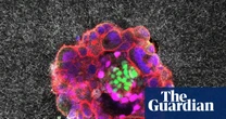 Scientists capture first footage of human embryo implanting in a uterus