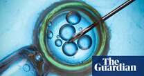 Scientists move step closer to making IVF eggs from skin cells