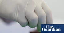 Mpox smuggling case prompts congressional scrutiny of National Institutes of Health