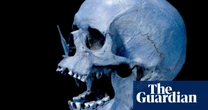 Ancient steppe herders brought higher risk of MS to northern Europe