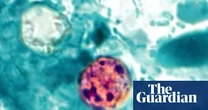 Former top US food safety official says Trump’s handling of cyclospora is ‘catastrophic’