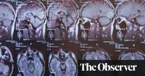 Rugby brain injury lawsuit stuck in legal limbo – and players are still suffering