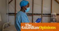 The Guardian view on Africa’s mpox outbreak: Covid lessons need to be learned | Editorial