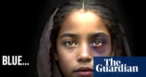 AI-generated ‘poverty porn’ fake images being used by aid agencies