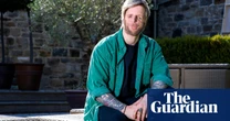 TV tonight: people with facial differences make a tough decision