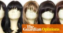 I thought I was fine with being bald. But the chance of a cure has stirred up all sorts of feelings | Emma Beddington