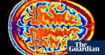 There’s little evidence of a ‘brain microbiome’ | Letter