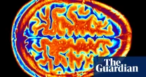 Medical research How AI is making non-invasive mind reading a reality – podcast