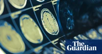 ‘Gift of life’: experts hail neck and head cancer breakthrough