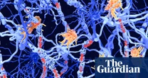 ‘Inverse vaccines’: the promise of a ‘holy grail’ treatment for autoimmune diseases