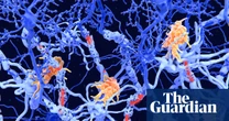 ‘Exciting’ clinical results offer hope for new class of MS therapies