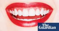 When veneers go very wrong: ‘I knew I’d made the biggest mistake of my life’