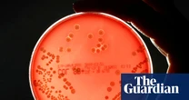 Superbugs could kill millions more and cost $2tn a year by 2050, models show