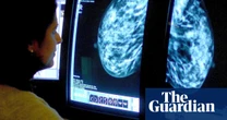 Extra cancer scans for women with dense breasts could save 700 lives a year – UK study