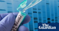 Gene therapy hailed as ‘medical magic wand’ for hereditary swelling disorder