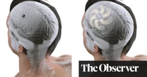 Brain implants to treat epilepsy, arthritis, or even incontinence? They may be closer than you think
