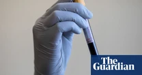 ‘Revolutionary’ DNA blood test to offer thousands in England tailored cancer care