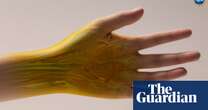 Transparent skin, bird flu, and why girls’ brains aged during Covid: the week in science – podcast