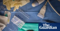 A tiny rhino foetus developed by IVF: Jon A Juárez’s best photograph