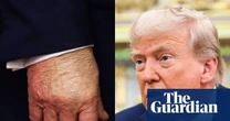 What the ‘is Trump dead?’ rumours reveal about our current moment