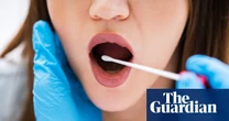Type of mouth bacteria ‘melts’ some cancers, study finds