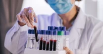 L'organo che invecchia prima e il rischio-morte: sangue, il test che cambia la storia