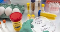 "Grande preoccupazione ": Aviaria, nuova pandemia? Come può avvenire il contagio