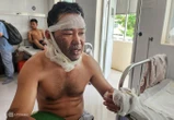 Công nhân vụ nổ nhà máy gỗ: 'Lửa như quả cầu phụt xa hàng chục mét'