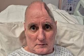 Cyclist has to have quarter of skull removed after hitting flytipped shed
