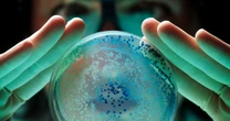 Warning over 'life-threatening' bacteria on common object that lives in your pocket
