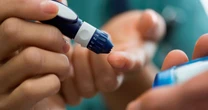 Diabetes breakthrough as over 150k patients offered 'game changing' artificial organDiabetes