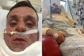 Dad 'set on fire' at house party shares video of charred body from hospital bed