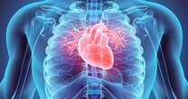 opinion'Test to identify heart issue could prevent sudden death in children and young people'