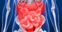 opinionBowel drug breakthrough after 'holy grail' discovery marks step towards Crohn’s-free world