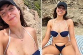 'I proudly show off my boob scars – people stare but they're here to stay'