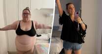 Woman who gorged on 10 chocolate bars a day sheds massive 19st - but loses an organ