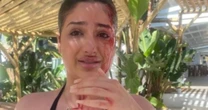 Brit covered in blood 'after being hit over head with Champagne bottle in sunbed row'