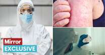 Pandemic 2025? 11 diseases docs most worried about - including Disease X and Covid 2.0