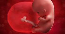 opinion'The placenta holds answers to unexplained miscarriages and stillbirths'