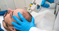 Hair loss treatment: Simple injection could be 'cure' for pattern baldnessNHS