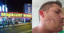 Brit arrested after 'leaving Magaluf doorman needing 50 stitches in horror bottle attack'