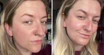 'I got expert advice for my chronic dry and sensitive skin – their tips to combat it surprised me'