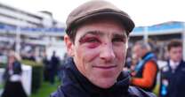 Top Cheltenham Festival jockey reveals surprise truth behind horrendous black eye