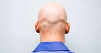 High court rules calling man 'bald' is harassment 'like commenting on women's breasts'