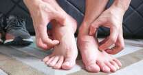 Itchy feet could be a sign of three chronic diseases - what to look out for