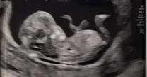 Football-mad dad stunned as team's crest spotted in scan of his unborn baby
