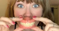 Woman loses all her teeth after gastric bypass forcing her to wear dentures at 32