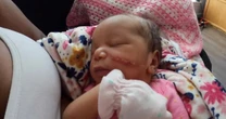 Newborn left needing 15 stitches on cheek after face was cut during C-section